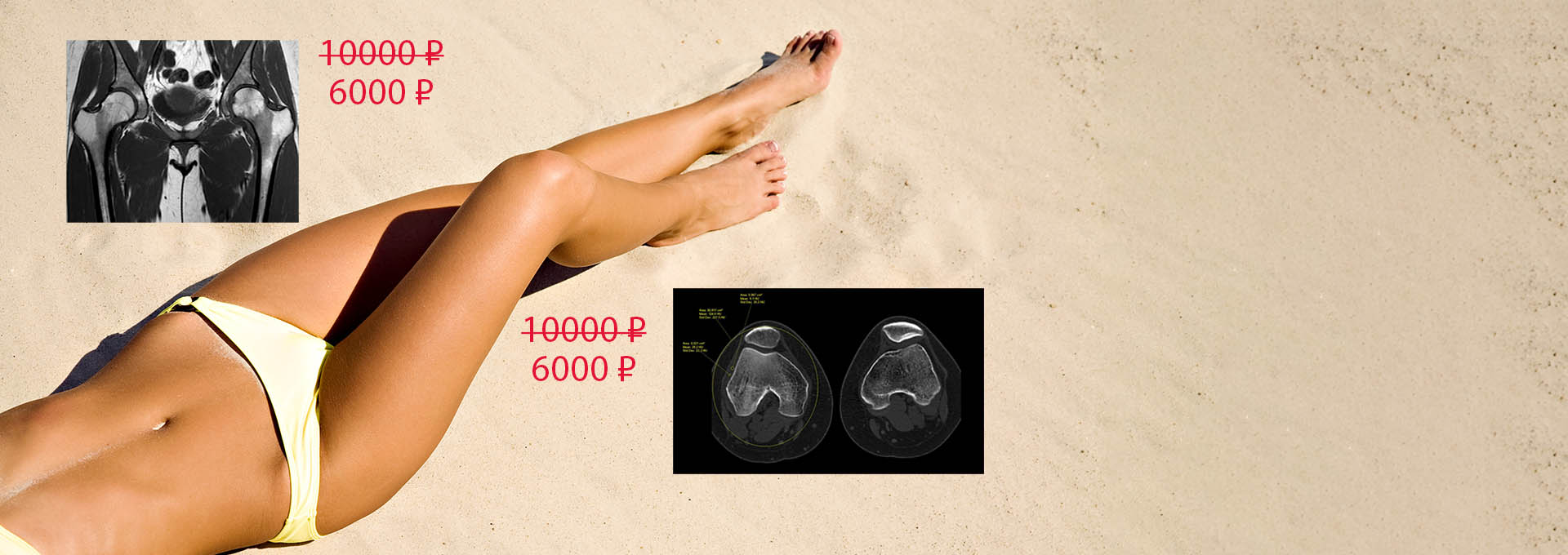 МРТ суставов<br>по акции!